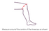 Thuasne Open Knee Support